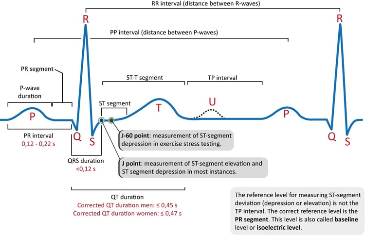 Figur 1. Den klassiske EKG-kurven med de vanligste bølgeformene. Viktige intervaller og målepunkter vises. EKG-tolkning krever kunnskap om disse bølgene og intervallene.