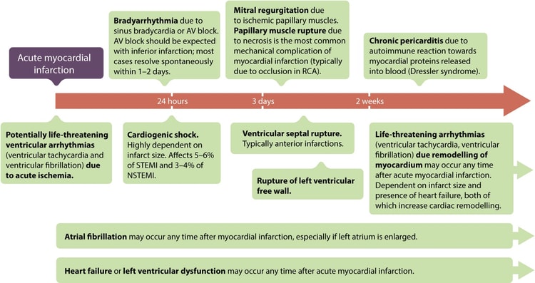 Figur 4. Akutte, subakutte og langsiktige komplikasjoner ved akutt (STEMI) og hjerteinfarkt generelt. RCA = høyre koronararterie. Tilpasset fra GW Reed et al, The Lancet (2017).