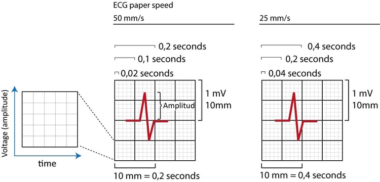 Figur 1. EKG-rutenettet. X-aksen viser tid, og y-aksen viser amplituden til de elektriske signalene som genereres i myokardiet. Det samme EKG-rutenettet brukes hos barn og voksne.