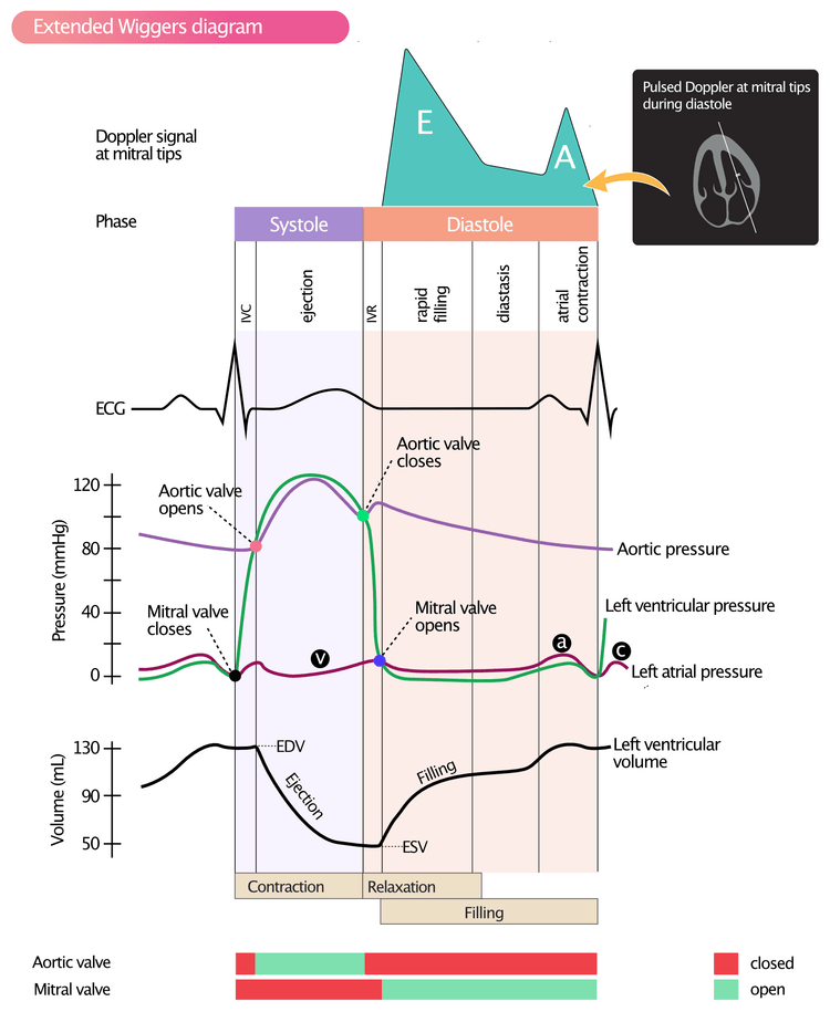 Figur 2. Wiggers-diagram som viser trykk, volum, dopplersignal, EKG og AV-klaffer i løpet av hjertesyklusen. Dopplerregistrering av transmitral flow under diastolen. (a) = aktiv atriefylling; (b) = økt atrialt trykk på grunn av at mitralklaffen buler inn i venstre atrium når klaffen lukkes; (c) = passiv atriefylling.
