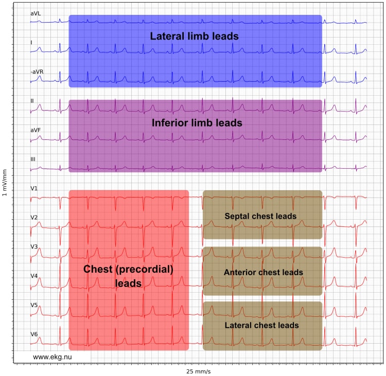 Figur 21. Presentasjon av EKG-avledningene i henhold til Cabrera-formatet, med aVR invertert til –aVR.