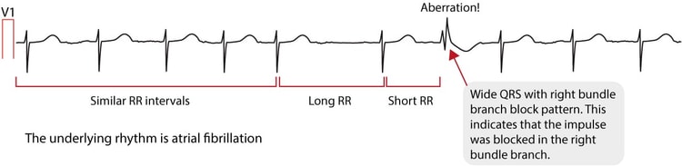 Figure 2. Ashman