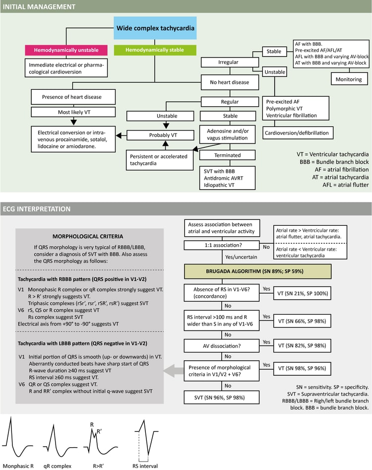 Figure 5. Management and ECG diagnosis of wide complex tachycardias.