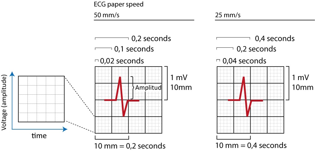 Figur 1. EKG-rutenettet. X-aksen viser tid, og y-aksen viser amplituden til de elektriske signalene som genereres i myokardiet. Det samme EKG-rutenettet brukes hos barn og voksne.