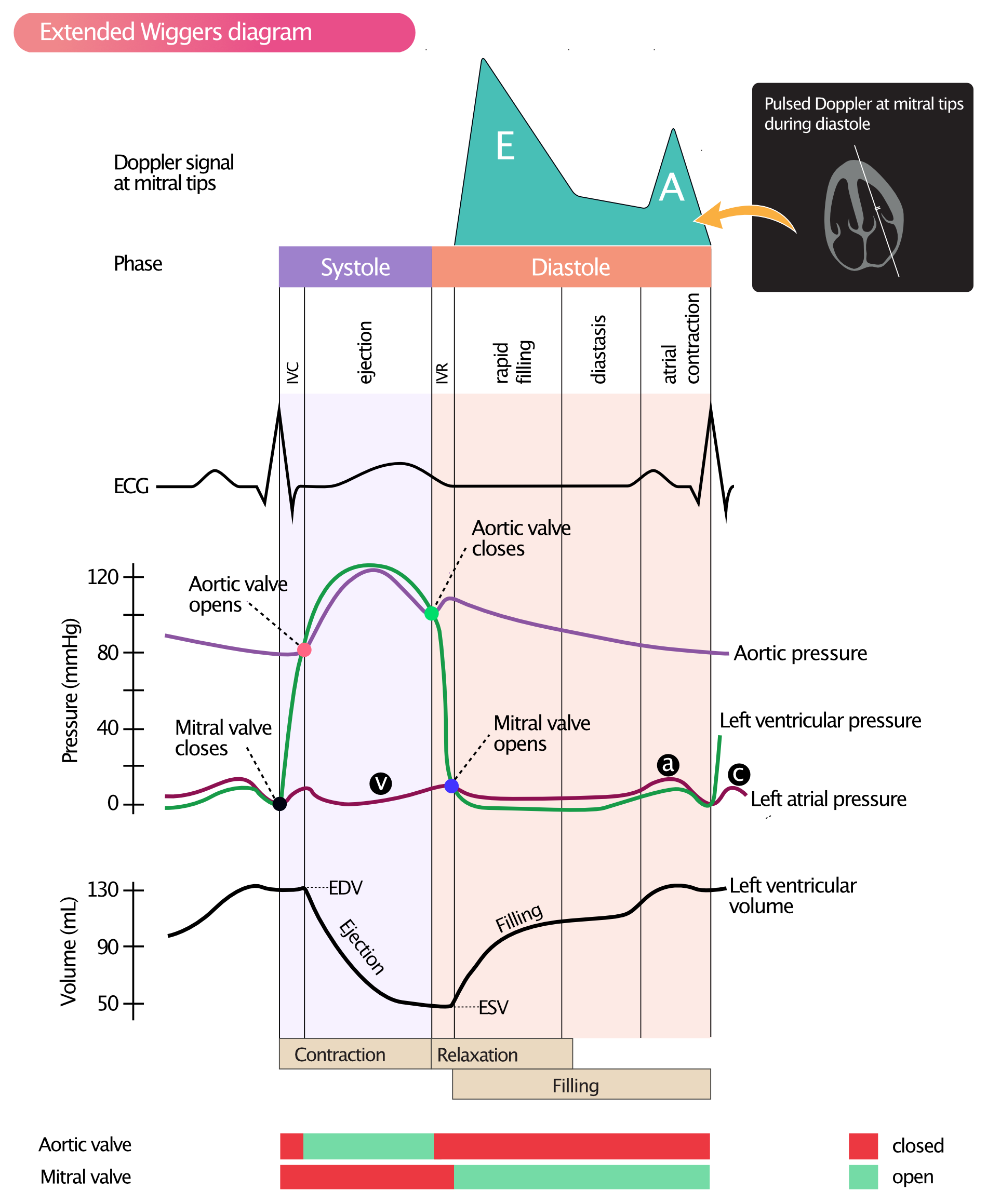 Figur 2. Wiggers-diagram som viser trykk, volum, dopplersignal, EKG og AV-klaffer i løpet av hjertesyklusen. Dopplerregistrering av transmitral flow under diastolen. (a) = aktiv atriefylling; (b) = økt atrialt trykk på grunn av at mitralklaffen buler inn i venstre atrium når klaffen lukkes; (c) = passiv atriefylling.