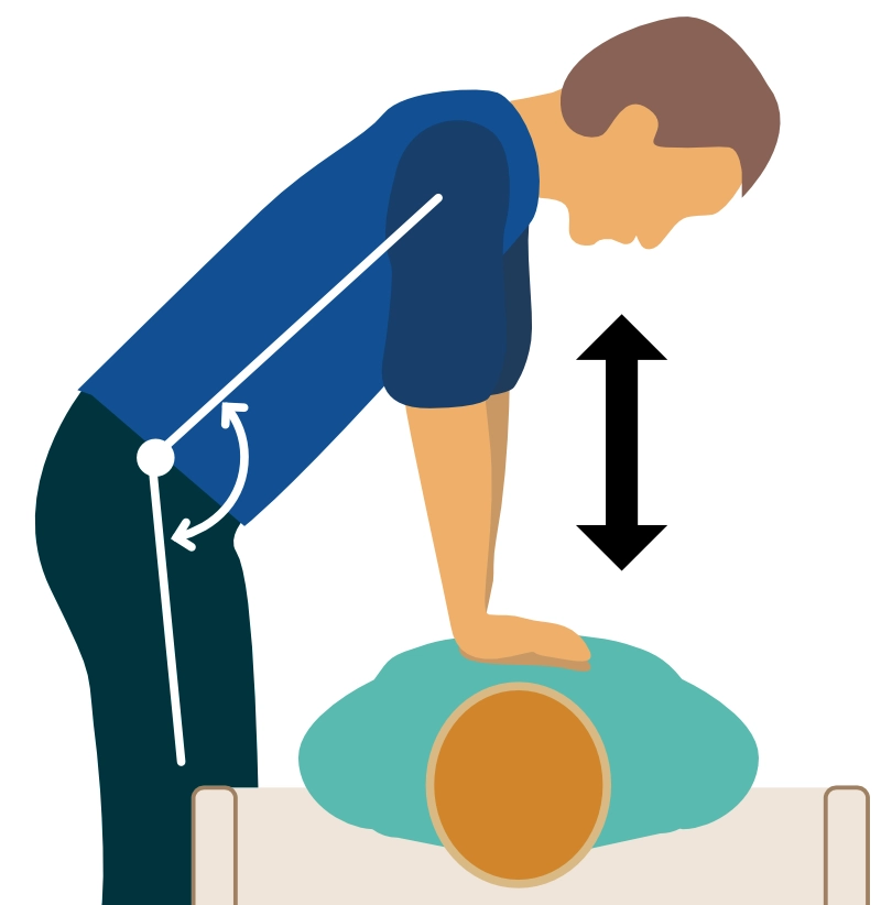 Figur 2. Manuelle brystkompresjoner ved ACLS.