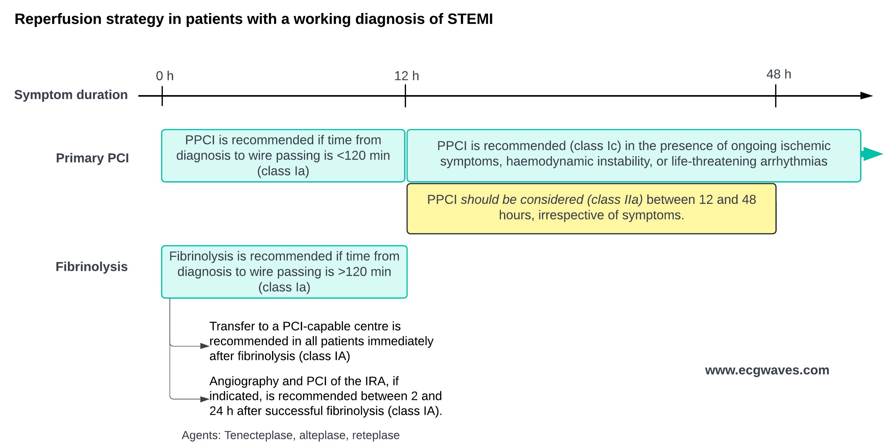 Tidslinje for valg av reperfusjonsstrategi ved STEMI, med primær PCI når tiden fra diagnose til ledevaierpassasje er under 120 minutter, fibrinolyse når den er over 120 minutter, og anbefalinger for symptomvarighet mellom 12 og 48 timer.