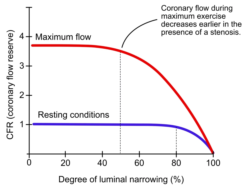 Diagram over myokardperfusjonsavbildning med SPECT og PET.