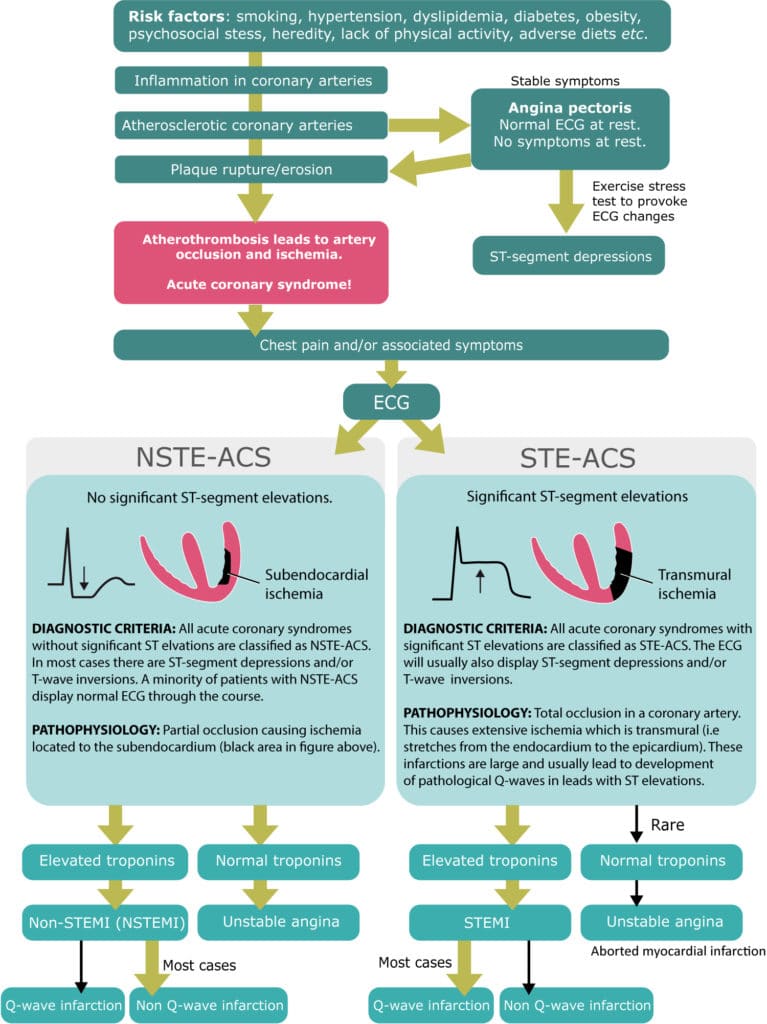 Figure 1. Flow-chart showing the natural course of coronary artery disease and classification of acute coronary syndromes into STEMI, NSTEMI and unstable angina using ECG criteria.