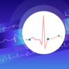 Klinisk EKG-tolkning