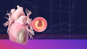 Cardiovascular Medicine