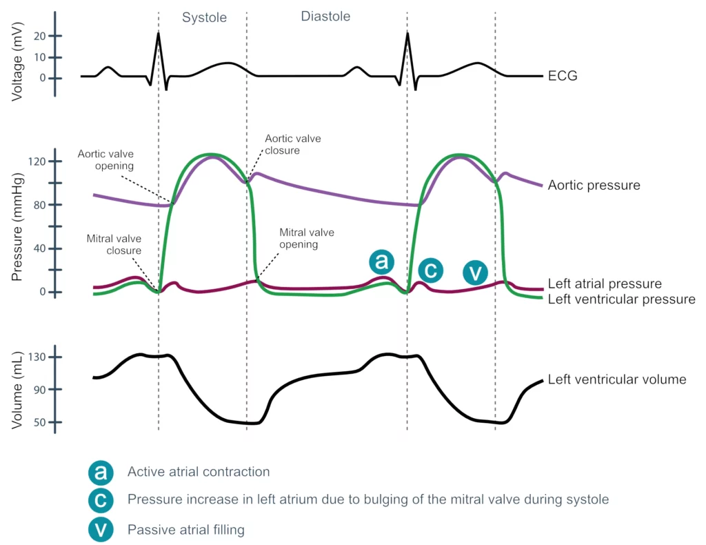 Figure 6. A Wiggers diagram is a standard diagram used in cardiac physiology to illustrate the association between aortic pressure, ventricular pressure, atrial pressure, volumes and ECG waveforms.