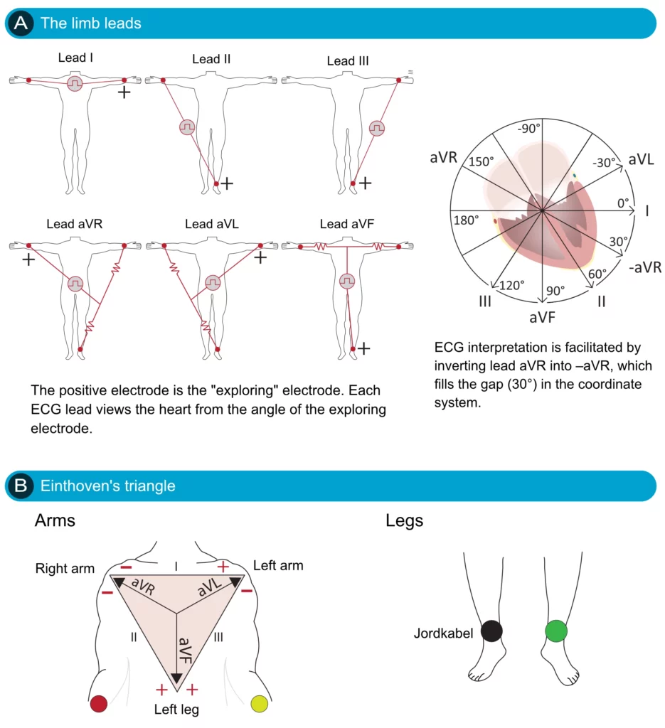 Figure 18. The organization of the limb leads.